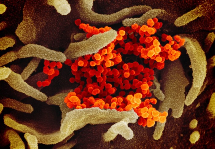报告称全球约三分之二的新冠病毒病例未被发现