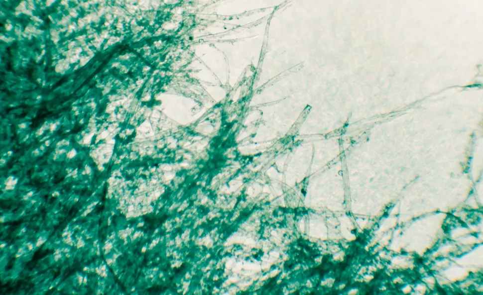 在显微镜下，这张撕破的纸片看起来像一束尖尖的纤维。 （图片来源：Getty Images 的 Nosyrevy）