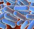 破坏 DNA 的肠道细菌可能助长炎症性肠病患者的结肠癌