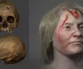 看看梅毒如何在 500 年前蹂躏一个女人的脸